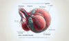Key Detection Tips for Testicular Cancer Self-Exams
