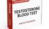 Testosterone Blood Test: A Guide for Derby Residents