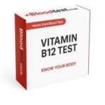 Vitamin B12 Blood Test for Exeter Residents: Key Details